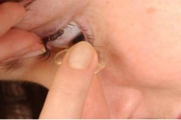 Scleral Contact Lens insertion