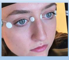 Face of a person during EDD