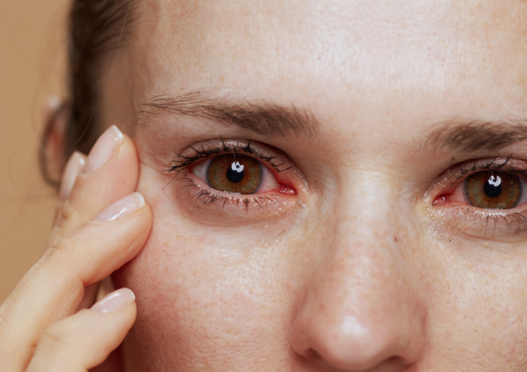 A fragment of a woman's face with a red eye