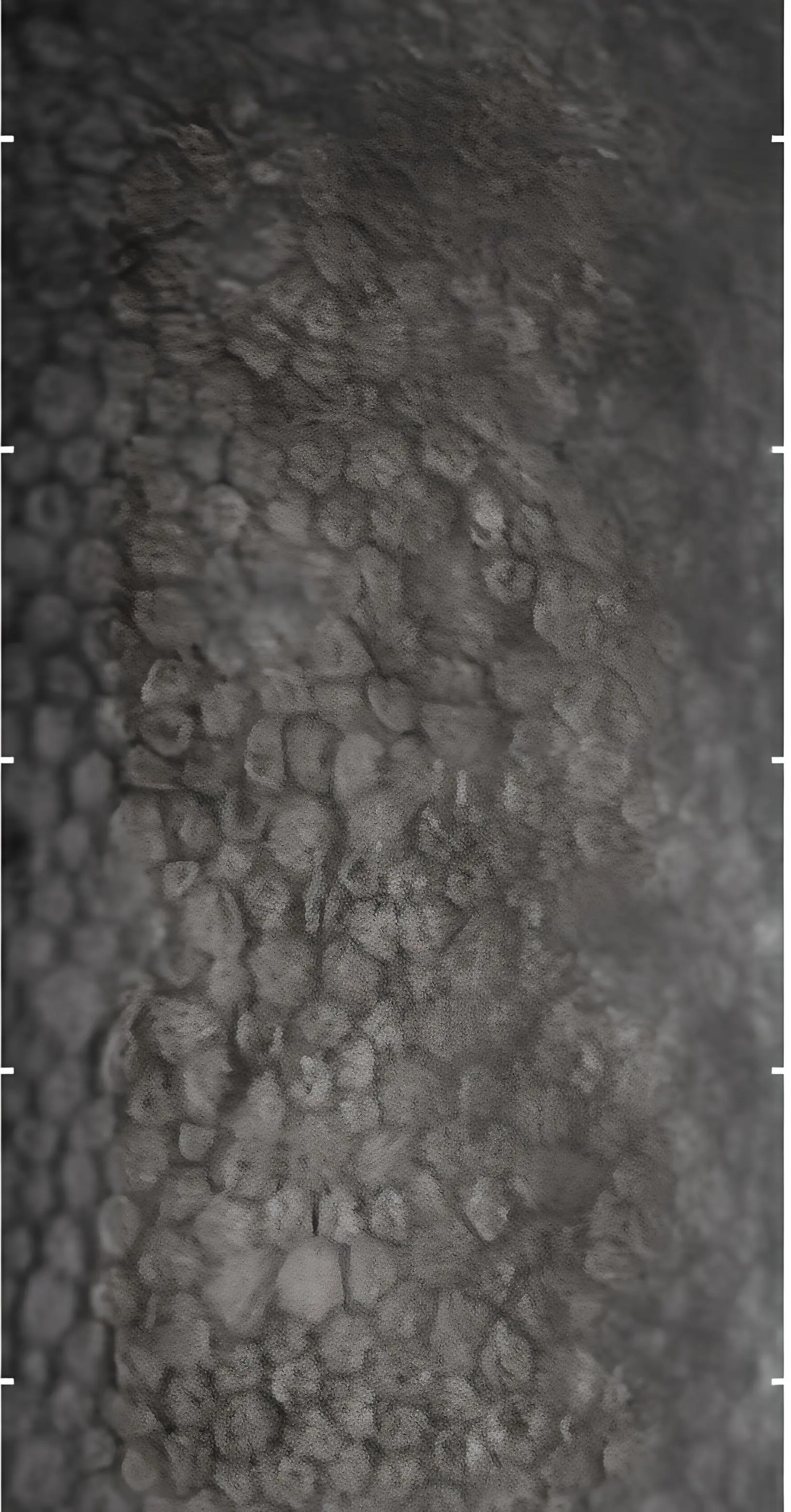 Image of endothelium cells
